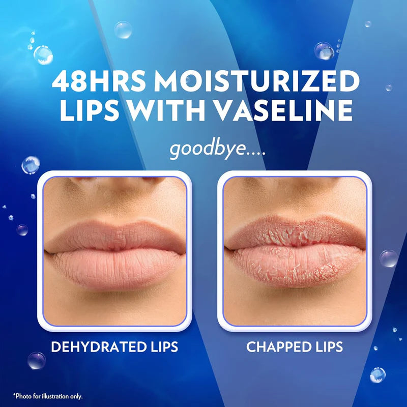 Vaseline - Lip Therapy Balm Stick